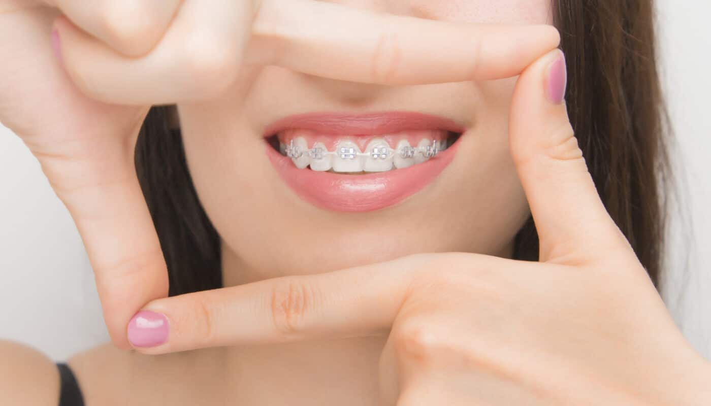 mutuelle pour orthodontie