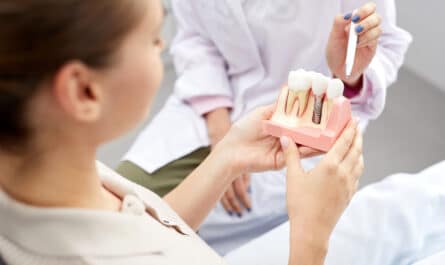 choisir implants dentaires