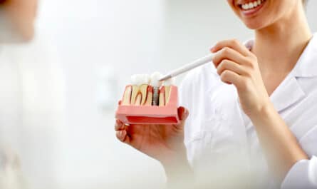 implants securite sociale
