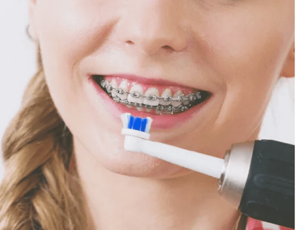 Peuton utiliser une brosse à dents électrique avec un appareil dentaire ? Quelle Assurance Santé